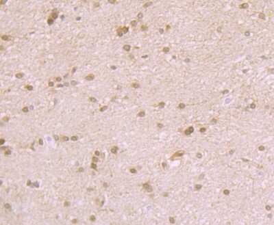 Immunohistochemistry-Paraffin: SYNE1 Antibody (JB35-26) [NBP2-75679] - Analysis of paraffin-embedded rat brain tissue using anti-Nesprin 1 antibody. Counter stained with hematoxylin.