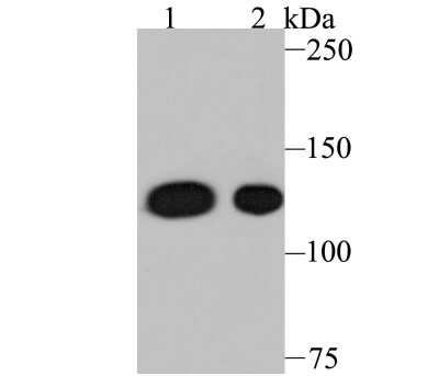 Western Blot: SYNE1 Antibody (JB35-26) [NBP2-75679] - Analysis of Nesprin 1 on different lysates using anti-Nesprin 1 antibody at 1/500 dilution. Positive control: Lane 1: A549 Lane 2: Mouse spleen tissue