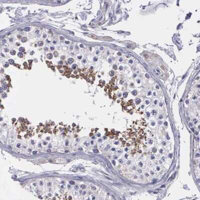 Immunohistochemistry: SYNJ2BP/ARIP2 Antibody [NBP1-88985] - Staining of human testis shows moderate granular cytoplasmic positivity in cells in seminiferous ducts.