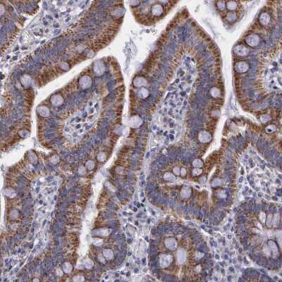 Immunohistochemistry-Paraffin SYNJ2BP/ARIP2 Antibody