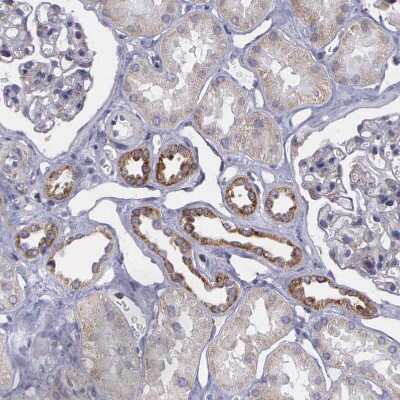 Immunohistochemistry-Paraffin SYNJ2BP/ARIP2 Antibody