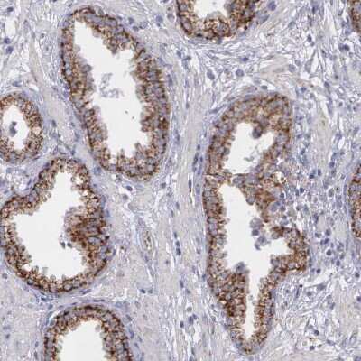 Immunohistochemistry-Paraffin: SYNJ2BP/ARIP2 Antibody [NBP1-88985] - Staining of human prostate shows strong granular cytoplasmic positivity in glandular cells.