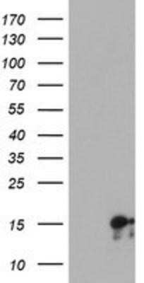 Western Blot: SYNJ2BP/ARIP2 Antibody (OTI3A9) - Azide and BSA Free [NBP2-74417] - HEK293T cells were transfected with the pCMV6-ENTRY control (Left lane) or pCMV6-ENTRY SYNJ2BP/ARIP2 (Right lane) cDNA for 48 hrs and lysed. Equivalent amounts of cell lysates (5 ug per lane) were separated by SDS-PAGE and immunoblotted with anti-SYNJ2BP/
