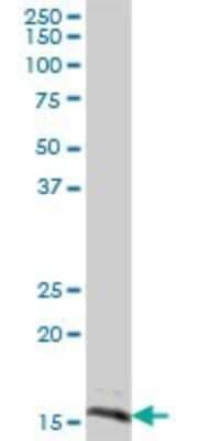 Western Blot: SYNJ2BP/ARIP2 Antibody [H00055333-B01P] - Analysis of SYNJ2BP expression in human kidney.