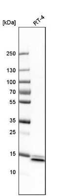 Western Blot: SYNJ2BP/ARIP2 Antibody [NBP1-88985] - Analysis in human cell line RT-4.