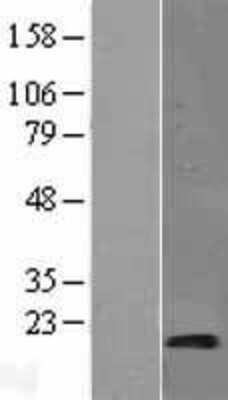 Western Blot SYNJ2BP/ARIP2 Overexpression Lysate
