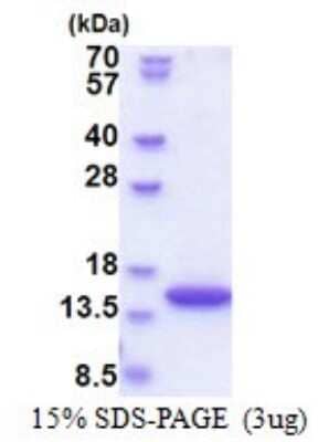 SDS-PAGE Recombinant Human SYNJ2BP/ARIP2 His Protein