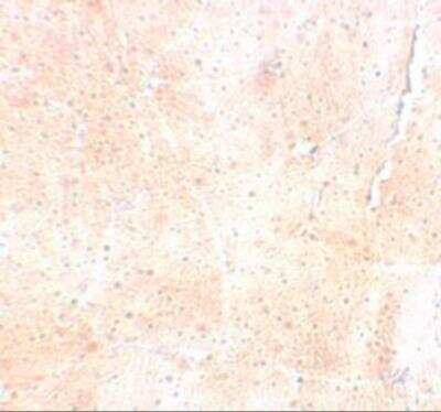 Immunohistochemistry-Paraffin SYNPO2 Antibody - BSA Free