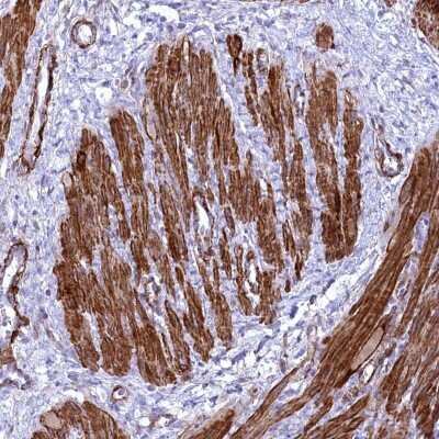 Immunohistochemistry-Paraffin SYNPO2 Antibody - BSA Free