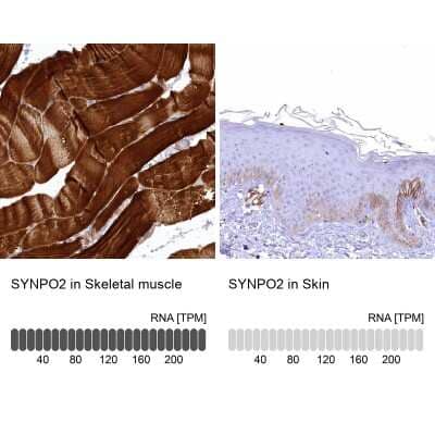 Immunohistochemistry-Paraffin SYNPO2 Antibody - BSA Free