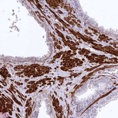 Immunohistochemistry-Paraffin: SYNPO2 Antibody [NBP2-48595] - Staining of human prostate shows strong cytoplasmic positivity in smooth muscle cells.