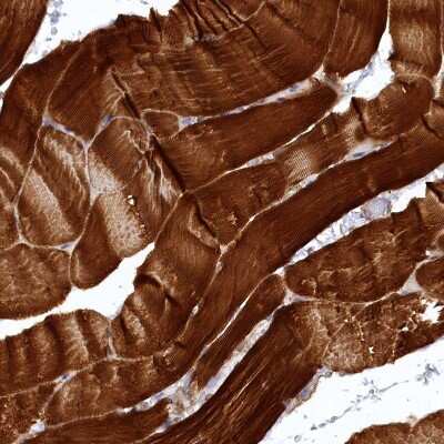 Immunohistochemistry-Paraffin: SYNPO2 Antibody [NBP2-48595] - Staining of human skeletal muscle shows strong cytoplasmic positivity in myocytes.