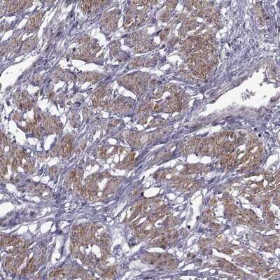 Immunohistochemistry-Paraffin SYNPO2 Antibody - BSA Free