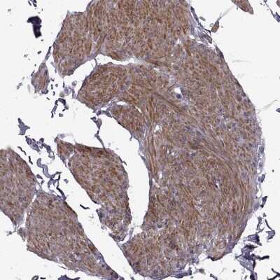 Immunohistochemistry-Paraffin SYNPO2 Antibody - BSA Free