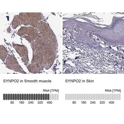 Immunohistochemistry-Paraffin SYNPO2 Antibody - BSA Free