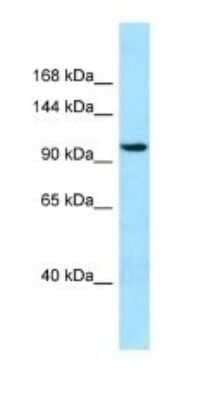 Western Blot: SYNPO2 Antibody [NBP1-98292] - Titration: 1.0 ug/ml Positive Control: 721_B Whole Cell.