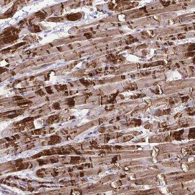 Immunohistochemistry-Paraffin: SYNPO2L Antibody [NBP2-34156] - Staining of human heart muscle shows strong cytoplasmic and membranous positivity in myocytes.