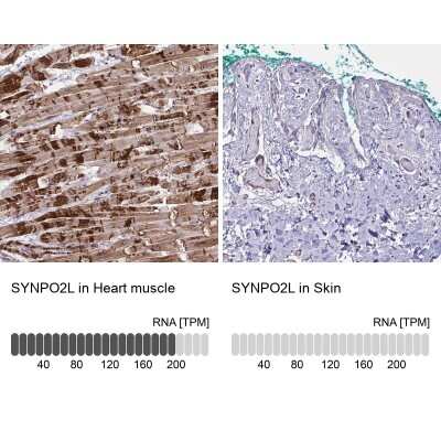 Immunohistochemistry-Paraffin: SYNPO2L Antibody [NBP2-34156] - Staining in human heart muscle and skin tissues using anti-SYNPO2L antibody. Corresponding SYNPO2L RNA-seq data are presented for the same tissues.