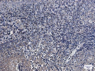 Immunohistochemistry-Paraffin: SYPL1 Antibody (S02-9K7) [NBP3-19976] - Immunohistochemistry of SYPL1 in paraffin-embedded Human tonsil using NBP3-19976 at dilution 1/20