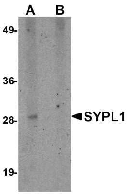 Western Blot: SYPL1 Antibody [NBP1-76316] - Human brain tissue lysate with SYPL1 antibody at 1 ug/mL in (A) the absence and (B) the presence of blocking peptide.