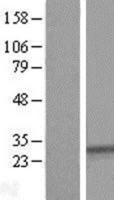 Western Blot: SYPL1 Overexpression Lysate (Adult Normal) [NBL1-16645] Left-Empty vector transfected control cell lysate (HEK293 cell lysate); Right -Over-expression Lysate for SYPL1.