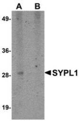 Western Blot: SYPL1 Peptide [NBP1-76316PEP] - blocks the antibody activity completely in Western blot by incubating the peptide with equal volume of antibody for 30 min at 37C.    