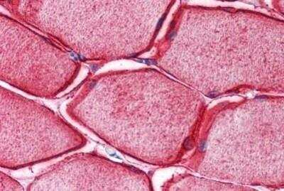 Immunohistochemistry-Paraffin: SYPL2 Antibody [NBP1-72119] - Analysis of anti-SYPL2 antibody with human skeletal muscle at concentration 5 ug/ml.