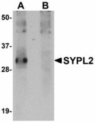 Western Blot: SYPL2 Antibody [NBP1-72119] - Western blot of SYPL2 in human spleen tissue lysate with SYPL2 antibody at 1 ug/ml in (A) the absence and (B) the presence of blocking peptide.