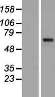 Western Blot: SYT10 Overexpression Lysate (Adult Normal) [NBP2-04657] Left-Empty vector transfected control cell lysate (HEK293 cell lysate); Right -Over-expression Lysate for SYT10.