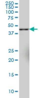 Western Blot SYT11 Antibody (4E1)