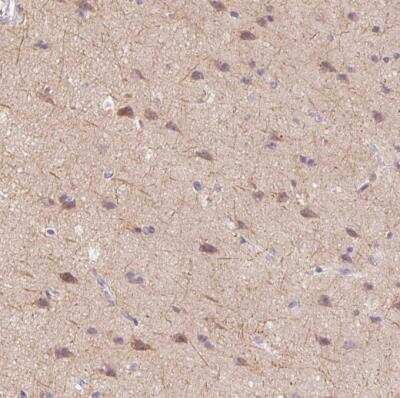 Immunohistochemistry-Paraffin: SYT11 Antibody [NBP2-39015] - Staining of human cerebral cortex shows moderate cytoplasmic positivity in neuronal cells.