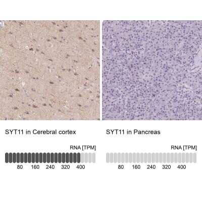 Immunohistochemistry-Paraffin: SYT11 Antibody [NBP2-39015] - Analysis in human cerebral cortex and pancreas tissues using NBP2-39015 antibody. Corresponding SYT11 RNA-seq data are presented for the same tissues.