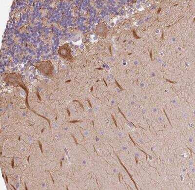Immunohistochemistry-Paraffin: SYT11 Antibody [NBP2-39015] - Staining of human cerebellum shows strong cytoplasmic positivity in Purkinje cells.