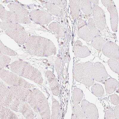 Immunohistochemistry-Paraffin: SYT11 Antibody [NBP2-39015] - Staining of human skeletal muscle shows no positivity in myocytes as expected.