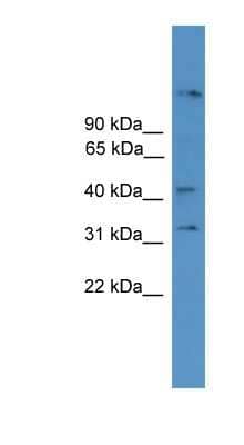 Western Blot: SYT11 Antibody [NBP1-69190] - MCF-7 whole cell lysates, concentration 0.2-1 ug/ml.