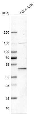 Western Blot: SYT11 Antibody [NBP2-39015] - Analysis in human cell line SCLC-21H.