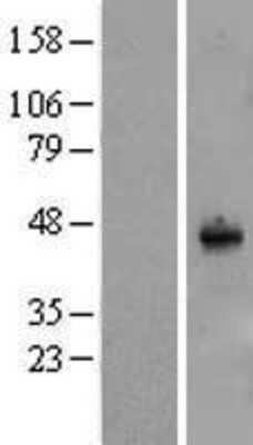 Western Blot SYT11 Overexpression Lysate