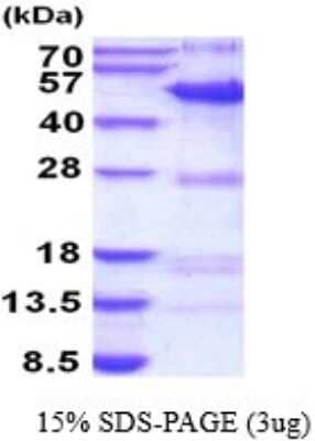 SDS-Page: SYT11 Recombinant Protein [NBP2-52167] - 15% SDS Page (3 ug)