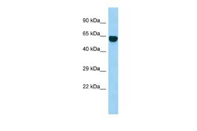 Western Blot SYT14 Antibody