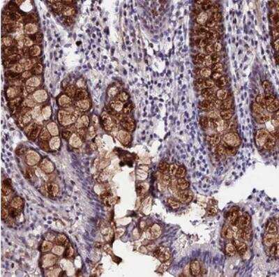Immunohistochemistry-Paraffin: SYT15 Antibody [NBP2-30856] - Staining of human colon shows strong cytoplasmic positivity in glandular cells.