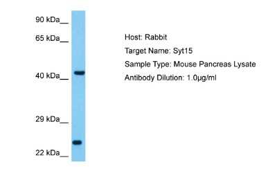 Western Blot: SYT15 Antibody [NBP2-85862] - Host: Rabbit. Target Name: SYT15. Sample Tissue: Mouse Pancreas lysates. Antibody Dilution: 1ug/ml