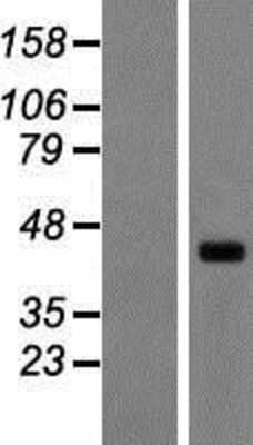 Western Blot: SYT15 Overexpression Lysate (Adult Normal) [NBP2-04903] Left-Empty vector transfected control cell lysate (HEK293 cell lysate); Right -Over-expression Lysate for SYT15.