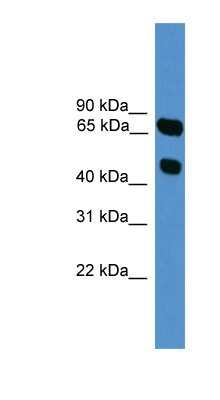 Western Blot: SYT16 Antibody [NBP1-69188] - Titration: 0.2-1 ug/ml, Positive Control: HepG2 cell lysate.