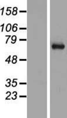 Western Blot SYT16 Overexpression Lysate