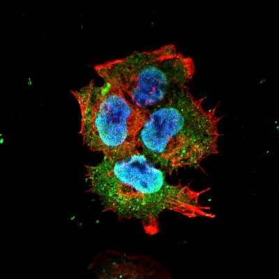 Immunocytochemistry/Immunofluorescence: SYT7 Antibody (S275-14) [NBP2-22420] - Tissue: Neuroblastoma cell line SK-N-BE. Species: Human. Fixation: 4% Formaldehyde for 15 min at RT. Primary Antibody: Mouse Anti-Synaptotagmin-7 Monoclonal Antibody at 1:100 for 60 min at RT. Secondary Antibody: Goat Anti-Mouse ATTO 488 at 1:100 for 60 min at RT. Counterstain: Phalloidin Texas Red F-Actin stain; DAPI (blue) nuclear stain at 1:1000; 1:5000 for 60 min RT, 5 min RT. Localization: Cytoplasmic Vesicle, Nucleus. Magnification: 60X.