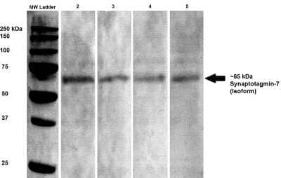 Western Blot: SYT7 Antibody (S275-14) [NBP2-22420] - Western Blot analysis of Rat brain lysates showing detection of SYT7 protein using Mouse Anti-SYT7 Monoclonal Antibody, Clone S275-14 (NBP2-22420). Primary Antibody: Mouse Anti-SYT7 Monoclonal Antibody (NBP2-22420) at 1:100, 1:250, 1:500, and 1:1000.