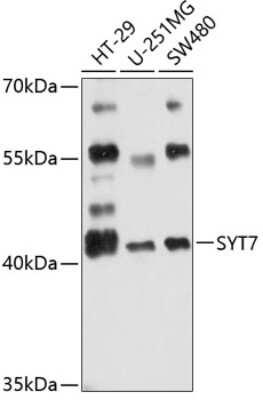 Western Blot: SYT7 Antibody [NBP2-93228] - Analysis of extracts of various cell lines, using SYT7 . Exposure time: 10s.