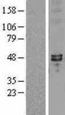 Western Blot: SYT7 Overexpression Lysate (Adult Normal) [NBL1-16655] Left-Empty vector transfected control cell lysate (HEK293 cell lysate); Right -Over-expression Lysate for SYT7.