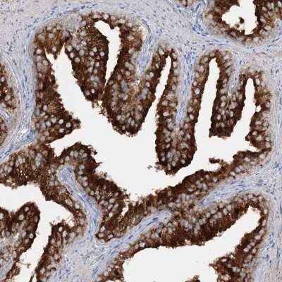 Immunohistochemistry-Paraffin: SYTL1 Antibody [NBP1-84764] - Staining of human prostate shows high expression.