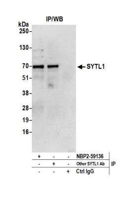 Immunoprecipitation: SYTL1 Antibody [NBP2-59136] - Detection of human SYTL1 by western blot of immunoprecipitates. Samples: Whole cell lysate (0.5 or 1.0 mg per IP reaction; 20% of IP loaded) from Jurkat cells prepared using NETN lysis buffer. Antibodies: Affinity purified rabbit anti-SYTL1 antibody NBP2-59136 used for IP at 8 ul per reaction. SYTL1 was also immunoprecipitated bya another rabbit anti-SYTL1 antibody. Detection: Chemiluminescence with an exposure time of 30 seconds.